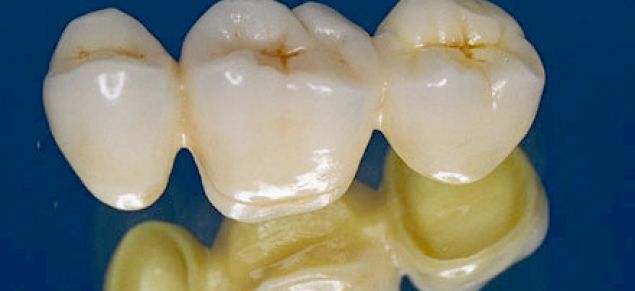 CORONE IN CERAMICA